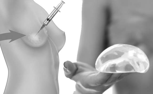 Fat Transfer Breast Augmentation Toronto - All Natural
